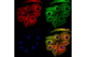 ABIN6265995 and ABIN6273344 staining Hela cells by IF/ICC.