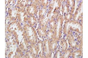 Paraformaldehyde-fixed, paraffin embedded rat kidney tissue, Antigen retrieval by boiling in sodium citrate buffer(pH6) for 15min, Block endogenous peroxidase by 3% hydrogen peroxide for 30 minutes, Blocking buffer (normal goat serum) at 37°C for 20min, Antibody incubation with Rabbit Anti-IGSF9 Polyclonal Antibody, Unconjugated  at 1:500 overnight at 4°C, followed by a conjugated secondary and DAB staining (IGSF9 抗体)