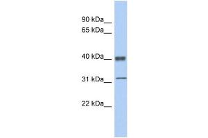 WB Suggested Anti-YBX1 Antibody Titration:  0. (YBX1 抗体  (Middle Region))