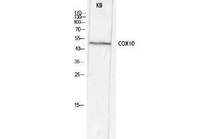 Western Blot (WB) analysis of KB lysis using COX10 antibody. (COX10 抗体  (Internal Region))