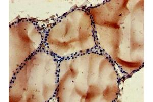 Immunohistochemistry of paraffin-embedded human thyroid tissue using ABIN7168384 at dilution of 1:100 (NOB1 抗体  (AA 103-229))