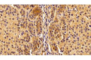 Immunohistochemistry (IHC) image for anti-Nuclear Factor kappa B (NFkB) (AA 42-367) antibody (ABIN7434137)