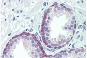 Human Prostate (formalin-fixed, paraffin-embedded) stained with FOXO3 antibody ABIN461993 at 1:100 followed by biotinylated goat anti-rabbit IgG secondary antibody ABIN481713, alkaline phosphatase-streptavidin and chromogen. (FOXO3 抗体  (pThr24, Thr32))