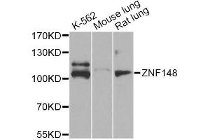 Western blot analysis of extracts of various cell lines, using ZNF148 Antibody (ABIN5974210) at 1/1000 dilution. (ZNF148 抗体)