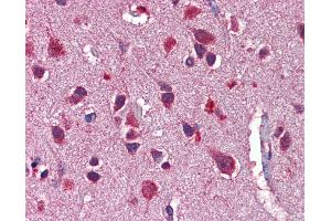 Immunohistochemistry (IHC) image for anti-Neuregulin 3 (NRG3) (Middle Region) antibody (ABIN2781935) (Neuregulin 3 抗体  (Middle Region))