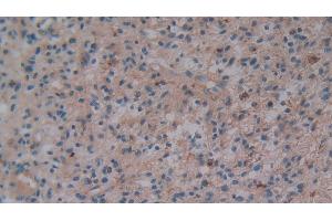 Immunohistochemistry (IHC) image for anti-Secreted phosphoprotein 1 (SPP1) (AA 18-314) antibody (ABIN7442486)