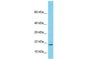 Host:  Rabbit  Target Name:  Supt4h1  Sample Type:  Rat Pancreas lysates  Antibody Dilution:  1. (SUPT4H 抗体  (Middle Region))