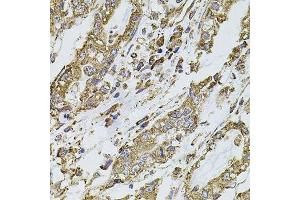 Immunohistochemistry (Paraffin-embedded Sections) (IHC (p)) image for anti-Phosphoinositide-3-Kinase, Catalytic, alpha Polypeptide (PIK3CA) (AA 401-600) antibody (ABIN3020829)