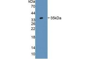 Detection of Recombinant AGXT2, Rat using Polyclonal Antibody to Alanine Glyoxylate Aminotransferase 2 (AGXT2) (AGXT2 抗体  (AA 225-512))