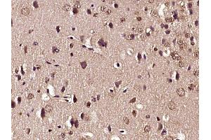 Paraformaldehyde-fixed, paraffin embedded mouse brain tissue, Antigen retrieval by boiling in sodium citrate buffer (pH6. (Glutamate Receptor 1 抗体  (pSer863))