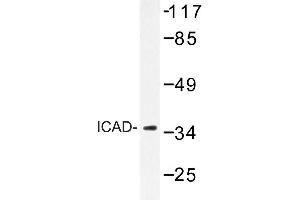 Image no. 1 for anti-DNA Fragmentation Factor, 45kDa, alpha Polypeptide (DFFA) antibody (ABIN272297) (DFFA 抗体)