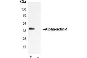 Immunoprecipitation of Alpha-actin-1 from 0.