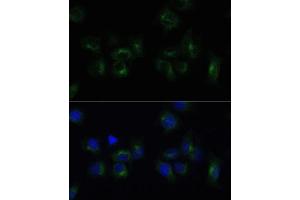 Immunofluorescence analysis of HeLa cells using CLTB Polyclonal Antibody (ABIN6131587, ABIN6138750, ABIN6138751 and ABIN6224454) at dilution of 1:100 (40x lens). (CLTB 抗体  (AA 1-211))