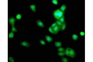 Immunofluorescence staining of HepG2 cells with ABIN7173357 at 1:166, counter-stained with DAPI. (TRIB1 抗体  (AA 3-91))