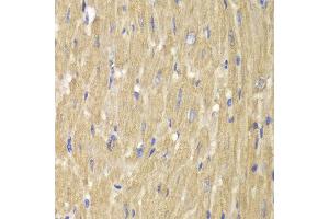 Immunohistochemistry of paraffin-embedded mouse heart using NCF2 antibody at dilution of 1:100 (400x lens). (NCF2 抗体)
