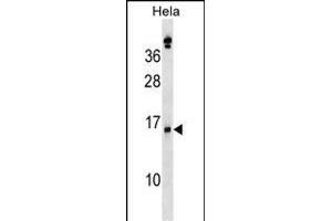 SLPI Antibody (Center) (ABIN1538516 and ABIN2848668) western blot analysis in Hela cell line lysates (35 μg/lane). (SLPI 抗体  (AA 59-88))