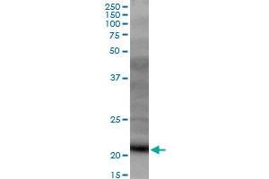 DR1 MaxPab polyclonal antibody. (DR1 抗体  (AA 1-176))