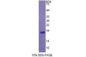 Image no. 1 for Interleukin 4 (IL4) (AA 25-153) (Active) protein (His tag) (ABIN6239747)