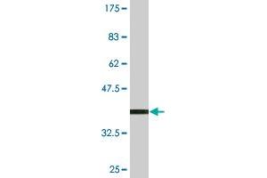 Western Blotting (WB) image for anti-Zinc Finger Protein 396 (ZNF396) (AA 131-230) antibody (ABIN531424)