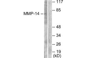 Western Blotting (WB) image for anti-Matrix Metallopeptidase 14 (Membrane-inserted) (MMP14) (C-Term) antibody (ABIN1848674) (MMP14 抗体  (C-Term))