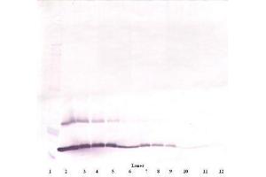 Image no. 2 for anti-Thymic Stromal Lymphopoietin (TSLP) antibody (ABIN465621) (Thymic Stromal Lymphopoietin 抗体)