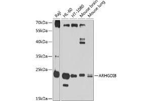 Western blot analysis of extracts of various cell lines, using ARHGDIB antibody (ABIN1678741, ABIN3018028, ABIN3018029 and ABIN6220341) at 1:1000 dilution.