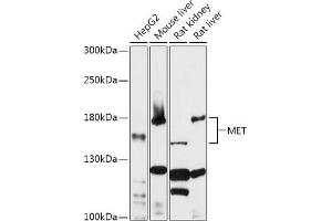 Western blot analysis of extracts of various cell lines, using MET antibody (ABIN1513199, ABIN5663553, ABIN5663555 and ABIN6213594) at 1:1000 dilution. (c-MET 抗体  (AA 25-325))