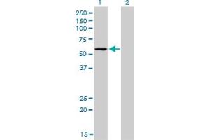 Western Blot analysis of STK38 expression in transfected 293T cell line by STK38 monoclonal antibody (M04), clone 2F3. (STK38 抗体  (AA 365-465))