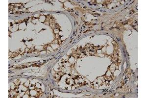 Image no. 1 for anti-Regulator of G-Protein Signaling 14 (RGS14) (AA 1-567) antibody (ABIN599517) (RGS14 抗体  (AA 1-567))