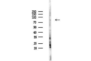 Western blot analysis of lysates from F10-LUC cells(heat-shock 45 min treatment), using Phospho-PKC delta (Tyr64) Antibody at 1/1000 dilution.