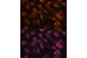 Immunofluorescence analysis of C6 cells using MEK7 antibody (ABIN3023156, ABIN3023157, ABIN3023158 and ABIN6219416) at dilution of 1:100. (MAP2K7 抗体  (AA 1-250))