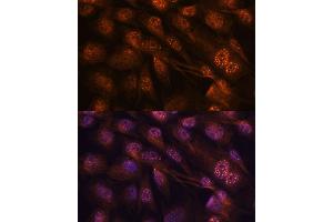 Immunofluorescence analysis of C6 cells using MEK7 antibody (ABIN3023156, ABIN3023157, ABIN3023158 and ABIN6219416) at dilution of 1:100. (MAP2K7 抗体  (AA 1-250))