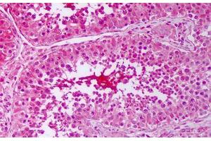 Immunohistochemistry (IHC) image for anti-Prostaglandin E Synthase 3 (Cytosolic) (PTGES3) antibody (ABIN1103835)