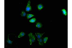 Immunofluorescence staining of MCF-7 cells with ABIN7173988 at 1:100, counter-stained with DAPI. (TYR 抗体  (AA 19-377))