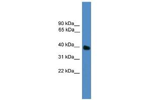 WB Suggested Anti-UBLCP1 Antibody Titration: 0. (UBLCP1 抗体  (N-Term))