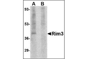 Western blot analysis of Rim3 in human brain tissue lysate with this product at 1 μg/ml in the (A) absence and (B) presence of blocking peptide. (RIMS3 抗体  (N-Term))
