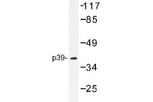 Image no. 1 for anti-Cyclin-Dependent Kinase 5, Regulatory Subunit 2 (p39) (CDK5R2) antibody (ABIN272221)