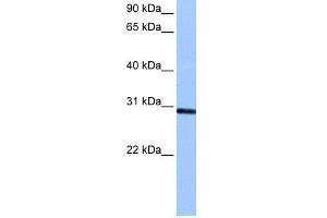 WB Suggested Anti-ASB11 Antibody Titration: 0. (ASB11 抗体  (C-Term))