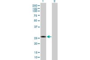 Western Blot analysis of RGS2 expression in transfected 293T cell line by RGS2 MaxPab polyclonal antibody. (RGS2 抗体  (AA 1-211))
