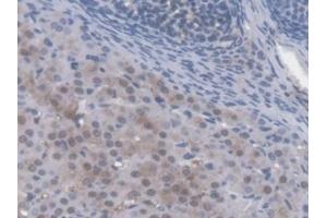 Detection of AMFR in Mouse Ovary Tissue using Polyclonal Antibody to Autocrine Motility Factor Receptor (AMFR) (AMFR 抗体  (AA 456-639))