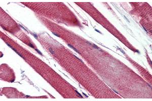 Immunohistochemistry (IHC) image for anti-Glutathione S-Transferase mu 2 (Muscle) (GSTM2) (N-Term) antibody (ABIN2777010)