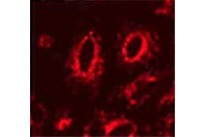 Lamp1 (Ly1C6), IF in transfected HeLa cells  Courtesy of Robert H Edwards, U of Cali, San Fran School of Medicine. (LAMP1 抗体)