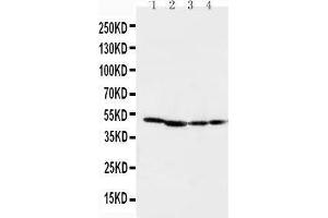 Anti-MEK1 antibody, Western blotting Lane 1: Rat Skeletal Muscle Tissue Lysate Lane 2: Rat Kidney Tissue Lysate Lane 3: CEM Cell Lysate Lane 4: COLO20 Cell Lysate (MEK1 抗体  (C-Term))