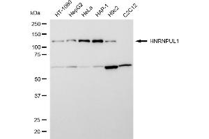 Western blotting analysis using HNRNPUL1 antibody (ABIN7798904).