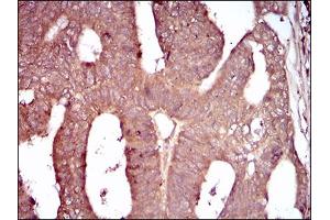 Immunohistochemistry (IHC) image for anti-CD93 (CD93) (AA 474-535) antibody (ABIN1724906)