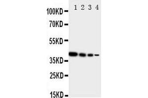 Western Blotting (WB) image for anti-V-Erb-A erythroblastic Leukemia Viral Oncogene Homolog 4 (Avian) (ERBB4) (AA 35-51), (N-Term) antibody (ABIN3044100)