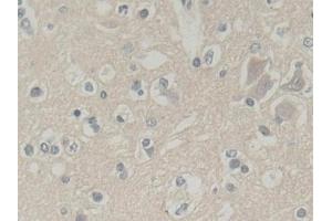 Immunohistochemistry (IHC) image for anti-Abl-Interactor 1 (ABI1) (AA 1-182) antibody (ABIN7436735)
