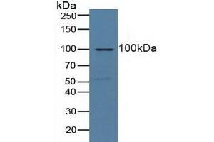 Detection of NCL in Human Lung Tissue using Polyclonal Antibody to Nucleolin (NCL) (Nucleolin 抗体  (AA 388-569))
