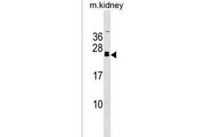 FGF20 Antibody (C-term) (ABIN1536710 and ABIN2838307) western blot analysis in mouse kidney tissue lysates (35 μg/lane). (FGF20 抗体  (C-Term))