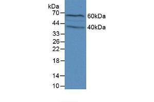 Western blot analysis of Mouse Brain Tissue. (Filaggrin 抗体  (AA 119-336))
